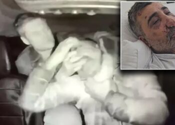 İngiliz boksörün darbettiği taksici: Sebepsiz saldırdı, ısırdı, elini gözüme soktu