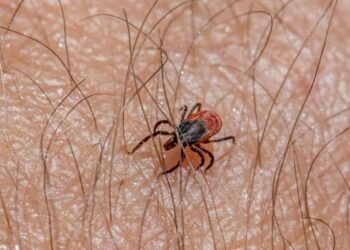 Yozgat’ta kene nedeniyle bir kişi daha hayatını kaybetti