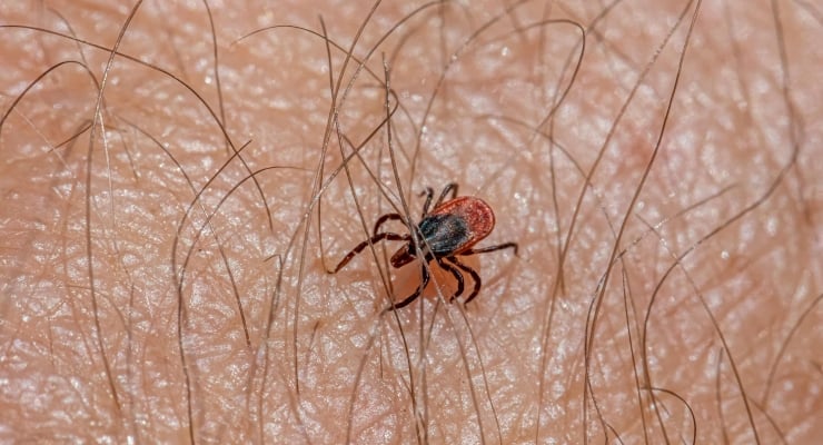 Yozgat'ta kene nedeniyle bir kişi daha hayatını kaybetti 1 Yozgat’ta kene nedeniyle bir kişi daha hayatını kaybetti
