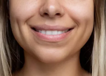 Yeni estetik çılgınlığı hızla yayılıyor: ‘Gamzeplasti’