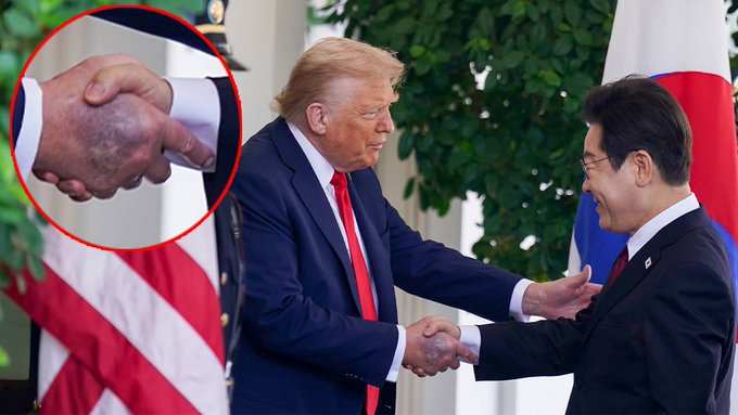 Beyaz Saray'dan Trump'ın elindeki morluklar için açıklama 1 Beyaz Saray’dan Trump’ın elindeki morluklar için açıklama