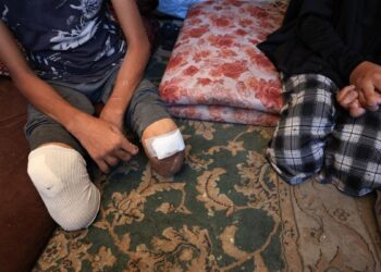 Gazze’de 7 Ekim’den bu yana 4 bin çocuk uzuvlarını kaybetti