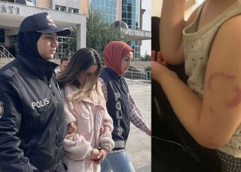 Öğrencisini ısıran kreş öğretmeni tutuklandı