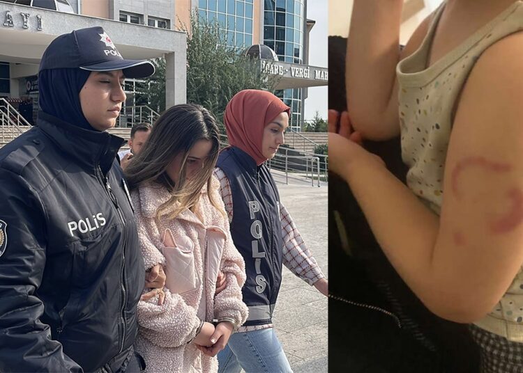 Öğrencisini ısıran kreş öğretmeni tutuklandı 1 Öğrencisini ısıran kreş öğretmeni tutuklandı