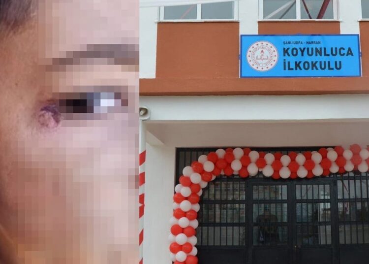 Çocuğun yüzünde sigara söndüren temizlik görevlisi tutuklandı