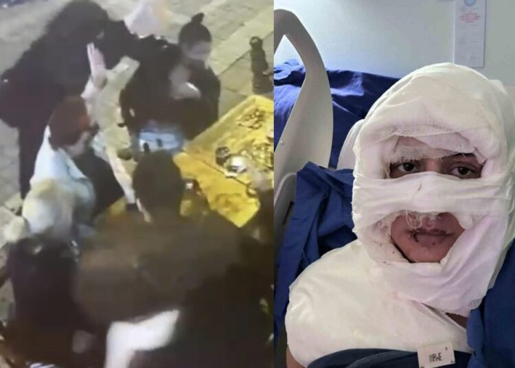 Yanıcı madde dökülüp yakılan kadın bıçaklatılmakla tehdit edildi 1 Yanıcı madde dökülüp yakılan kadın bıçaklatılmakla tehdit edildi