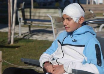 Taşla kafası parçalanan çocuğun kafatası titanyumla onarıldı