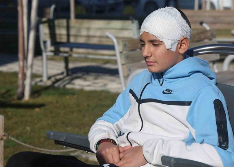 Taşla kafası parçalanan çocuğun kafatası titanyumla onarıldı