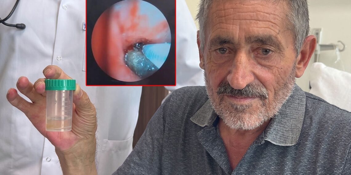 Anasayfa 69 Soluk borusundan çıkan doktorları bile şaşkına çevirdi