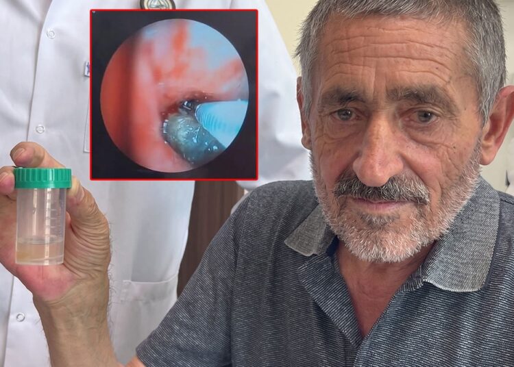 Soluk borusundan çıkan doktorları bile şaşkına çevirdi